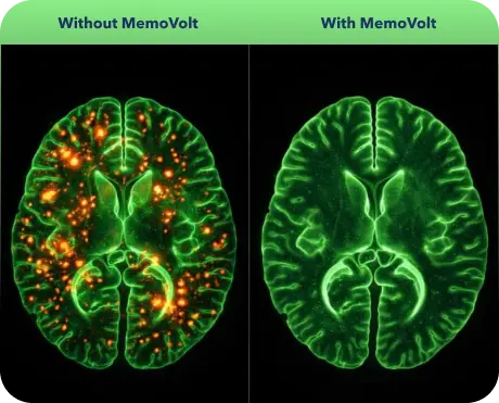 MemoVolt Brain Care Capsuls